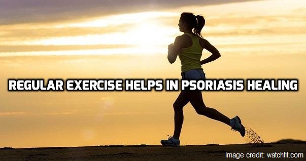 Regular exercise helps in Psoriasis healing