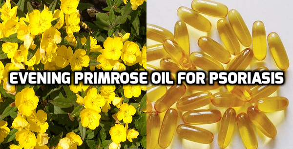 Evening primrose oil for psoriasis