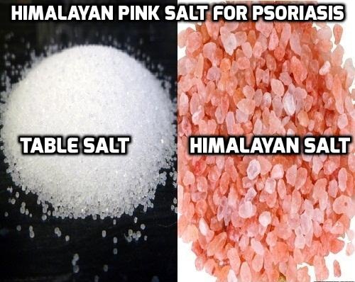 Himalayan Pink Salt for Psoriasis