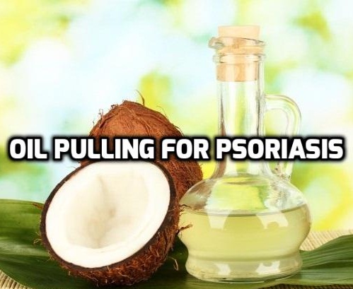 Oil Pulling for Psoriasis