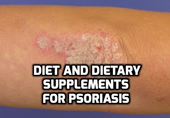Diet and Dietary supplements for Psoriasis