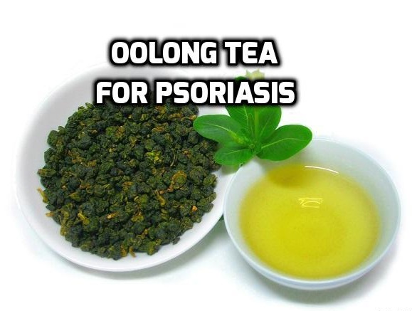Oolong tea for psoriasis