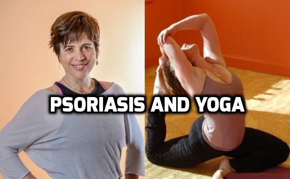 Yoga and Psoriasis