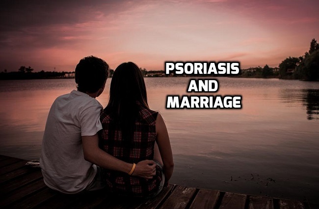 Psoriasis Marriage Matrimony India