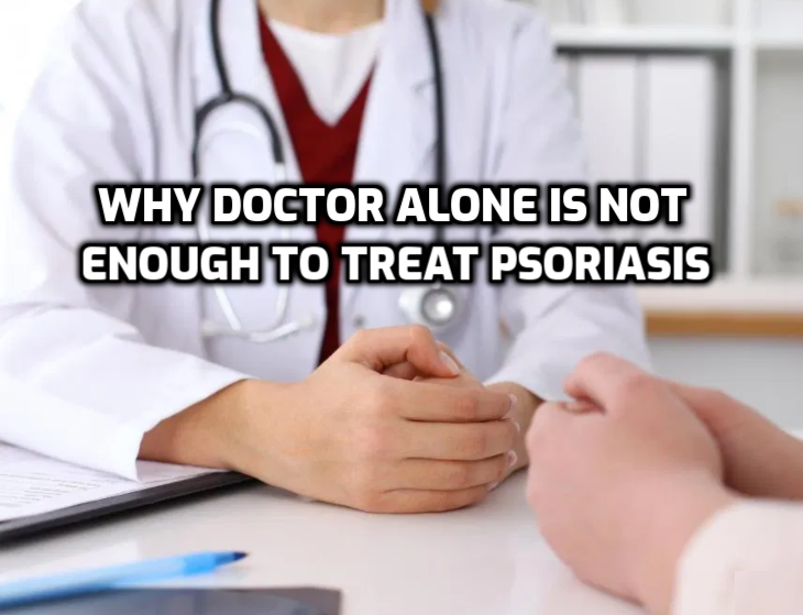 Doctor alone is not enough to treat Psoriasis