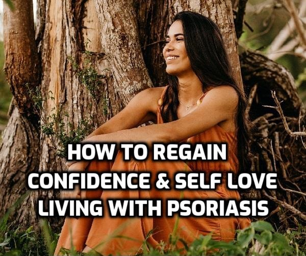 confidence and self love with psoriasis